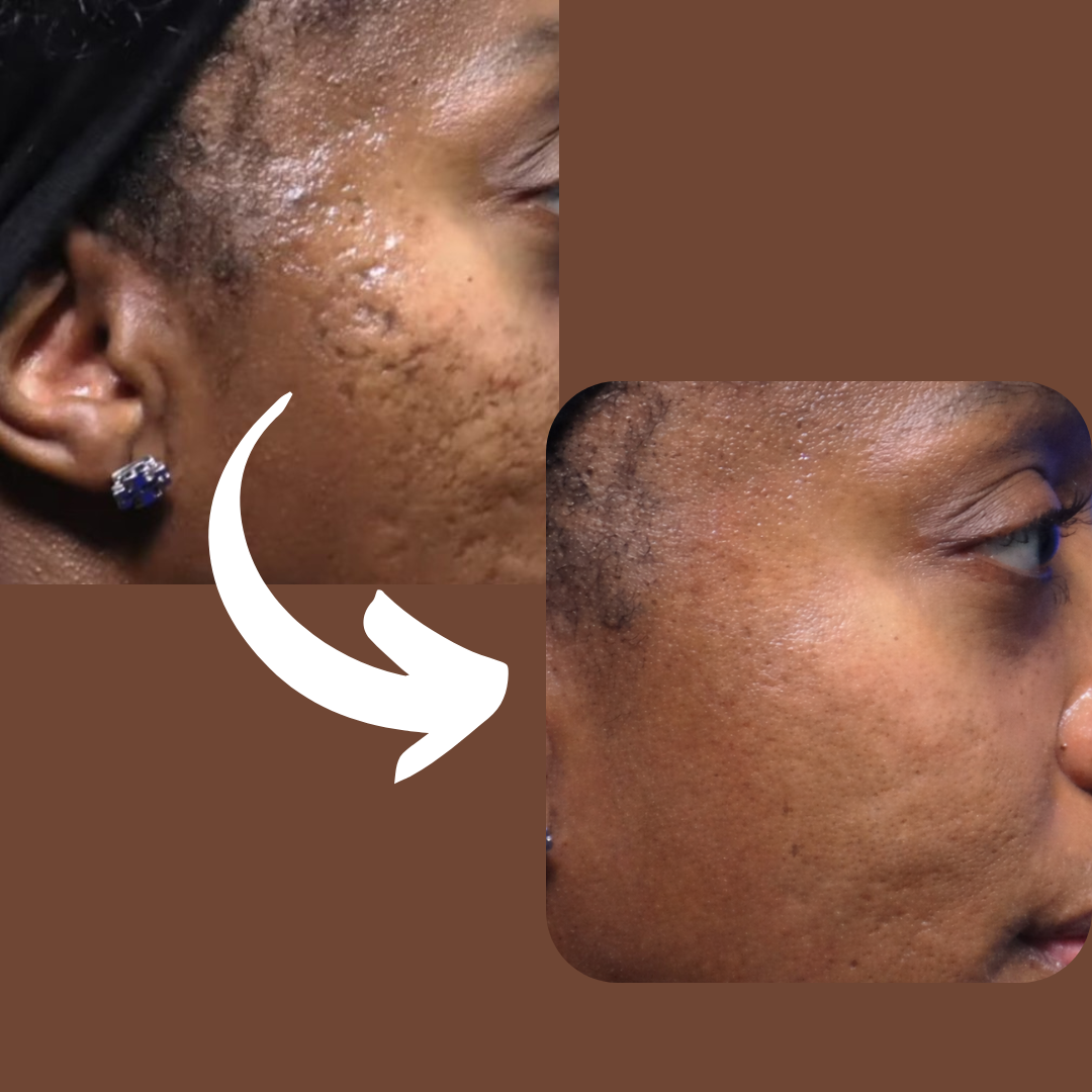 Face scar before after